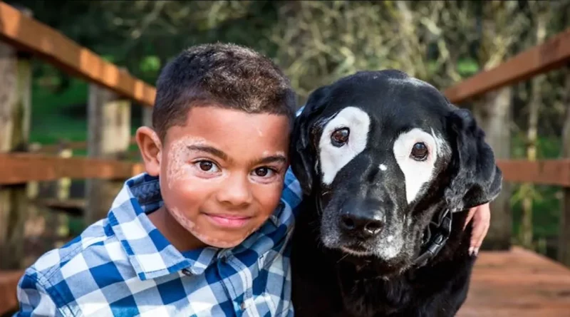 Niño avergonzado por su condición de piel se emociona al conocer a un perro con la misma